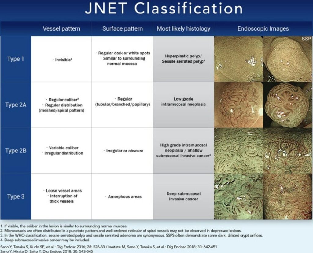 Jnet Classification