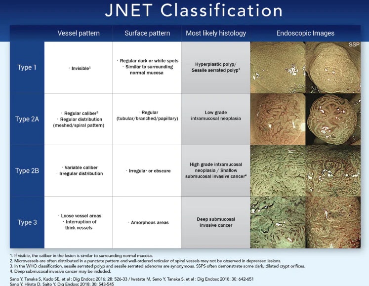 Jnet Classification For Colorectal Polyps