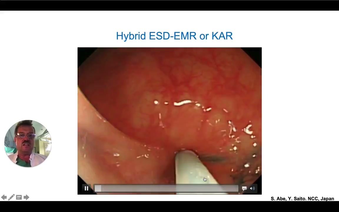 Kar Hybrid Esd-Emr: Circumferential Tip-Of-Snare Incision 1 Submucosal Injection Raising A Flat Lateral Spreading Tumor For Kar