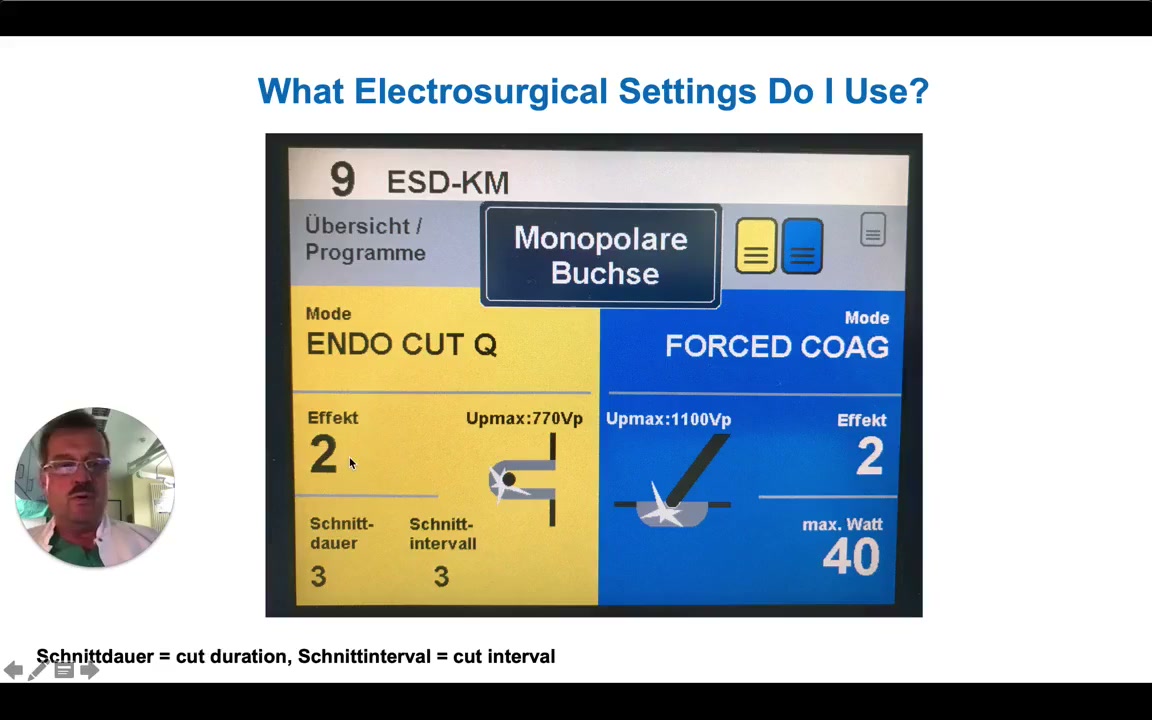 Kar Hybrid Esd-Emr: Circumferential Tip-Of-Snare Incision 3 Lesion Contracts Centrally After Circumferential Incision, Ready For Snare