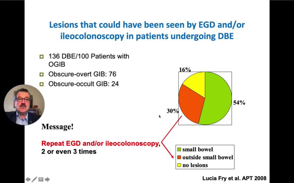 Mistakes In The Management Of Small Bowel Bleeding And How To Avoid Them