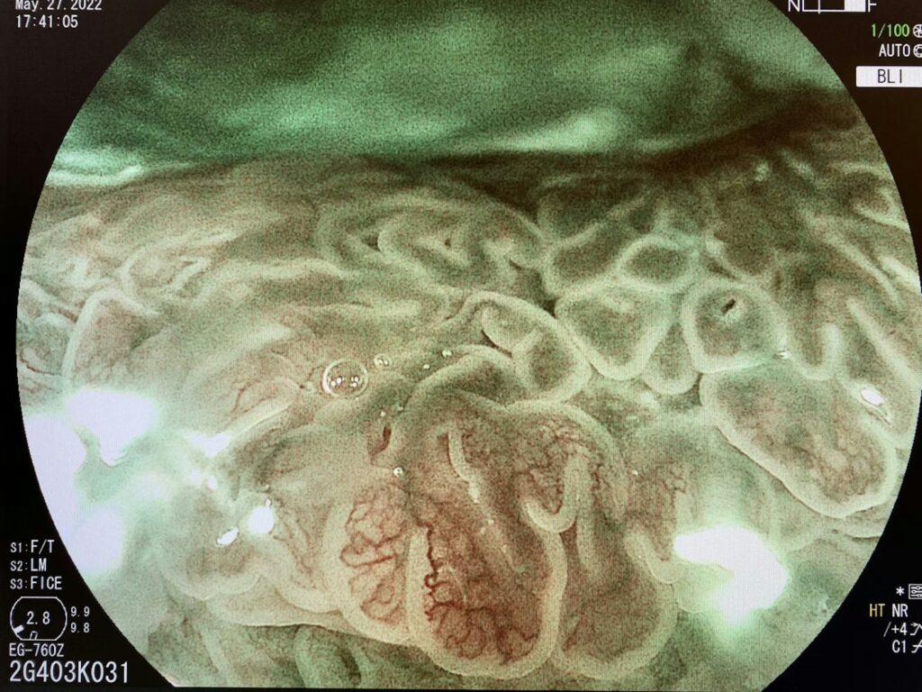 Neoplasia Or Not Neoplasia? 5 Neoplasia Or Not Neoplasia?