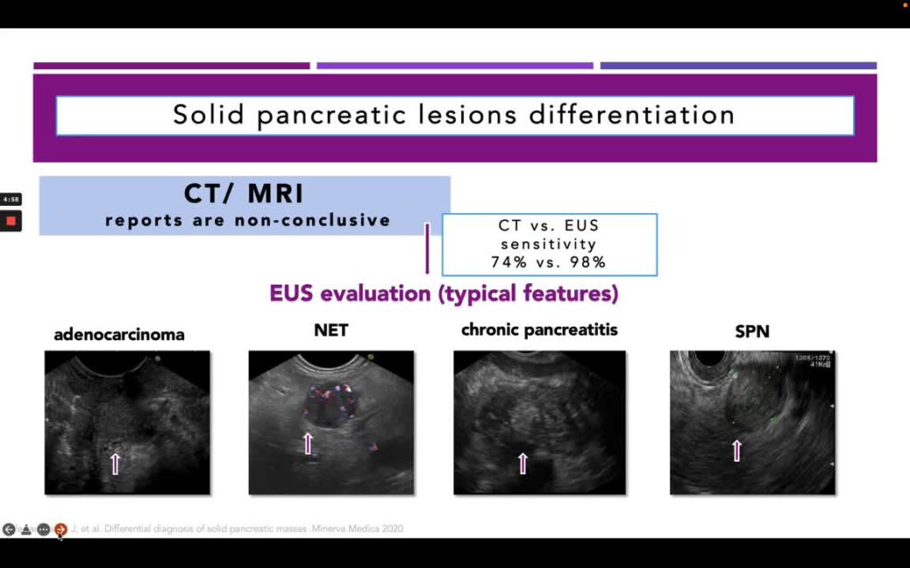 Non-Typical Features Of Well-Known Solid Pancreatic Lesions