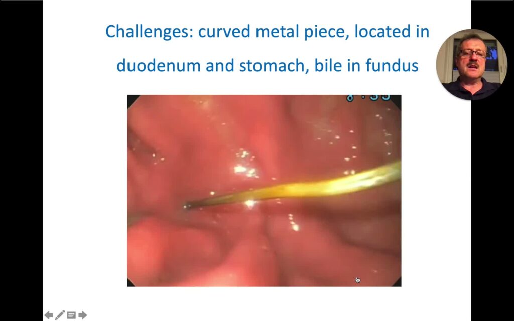 Overtubes In Gi Endoscopy: Part 1