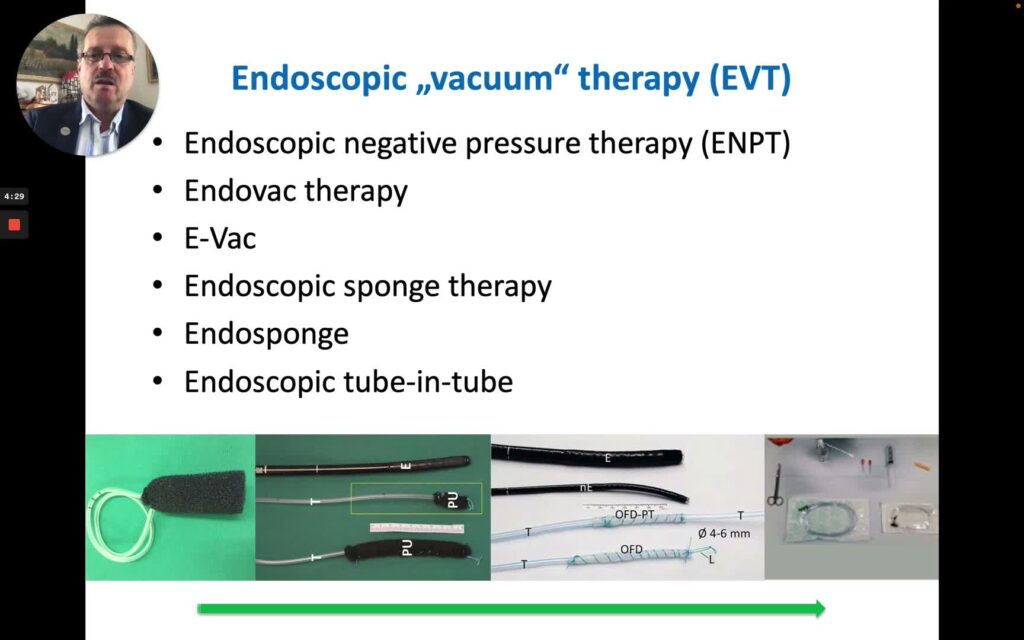 Principles of Endoscopic Vacuum Therapy