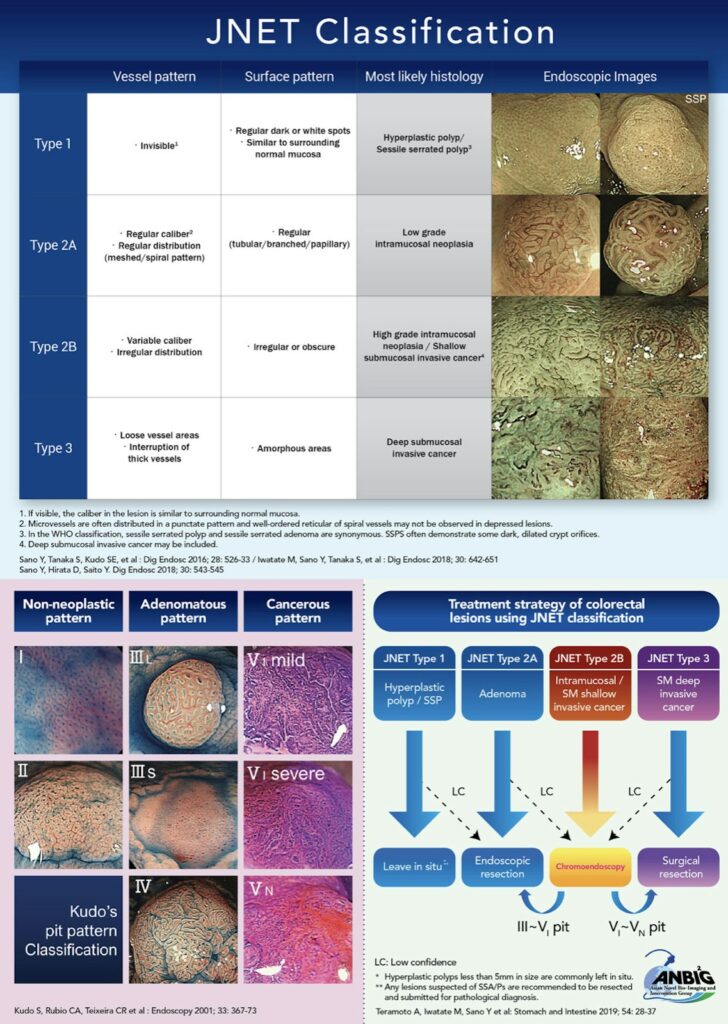 Reference Guide For Nbi Classifications For Colon Lesions