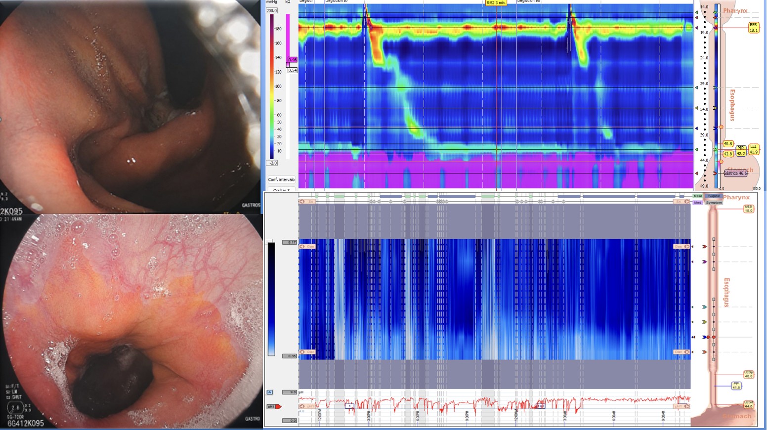 Gi Endoscopy Community &Amp; Education - Endocollab