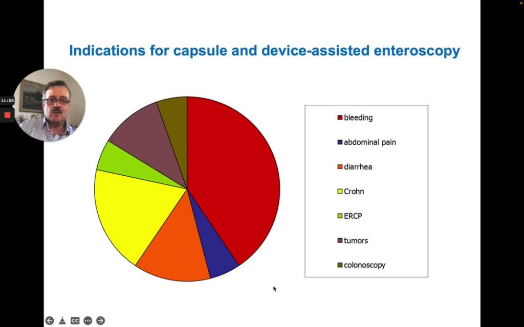 Rol de Enteroscopía para el Diagnóstico de Enfermedades del Intestino Delgado