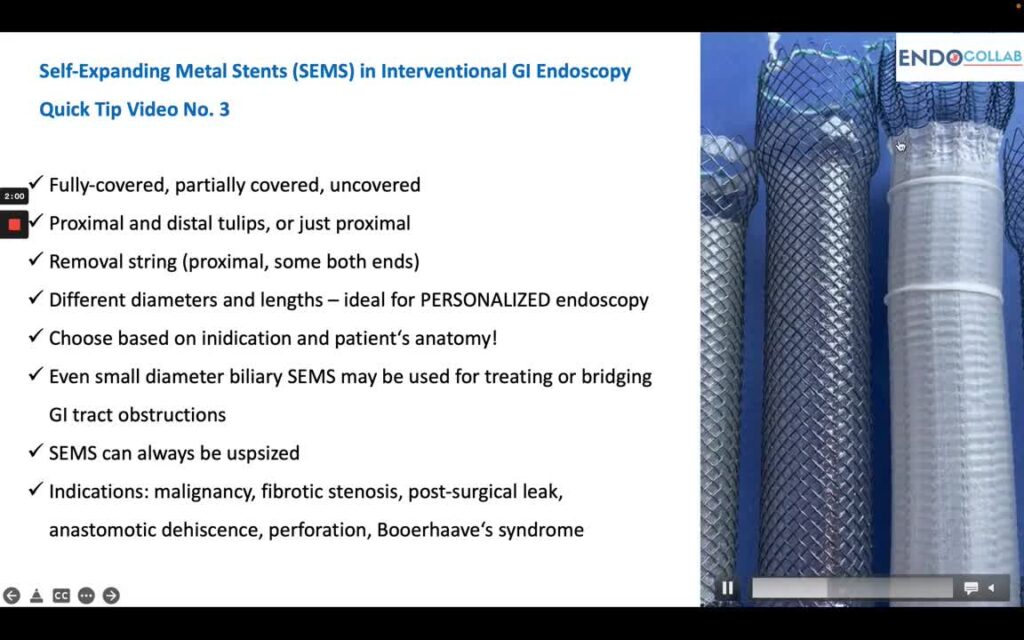 Self-Expanding Metal Stents (Sems) – Essentials (Quick Tip Video No 3)