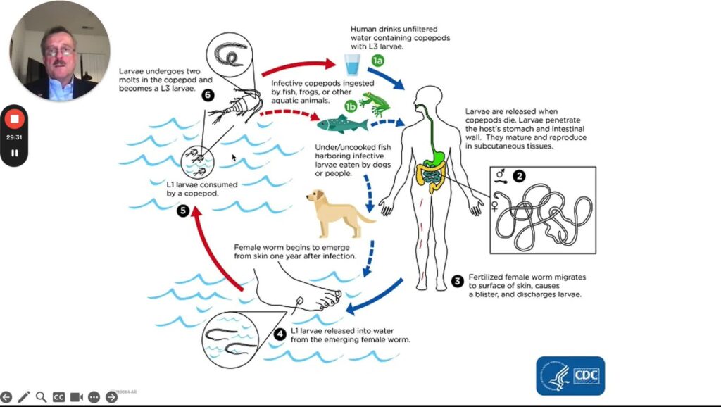 Skin Manifestations of GI Diseases, part 6 – GI infections