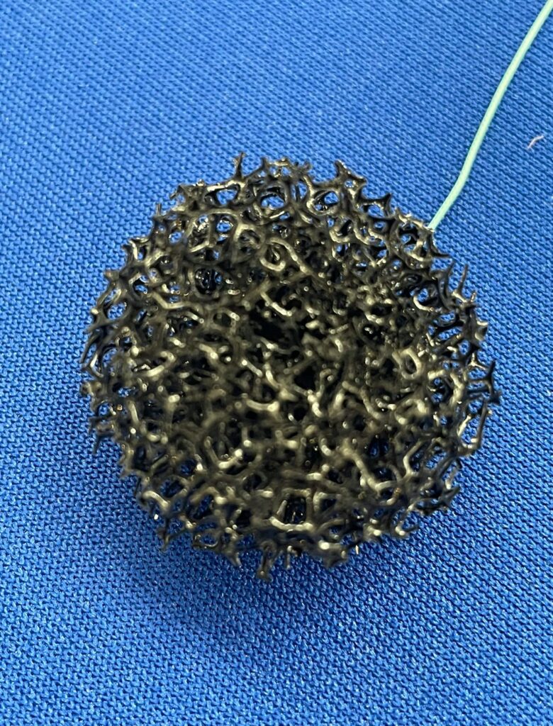 Sponge for Diagnosis of Barrett’s Esophagus