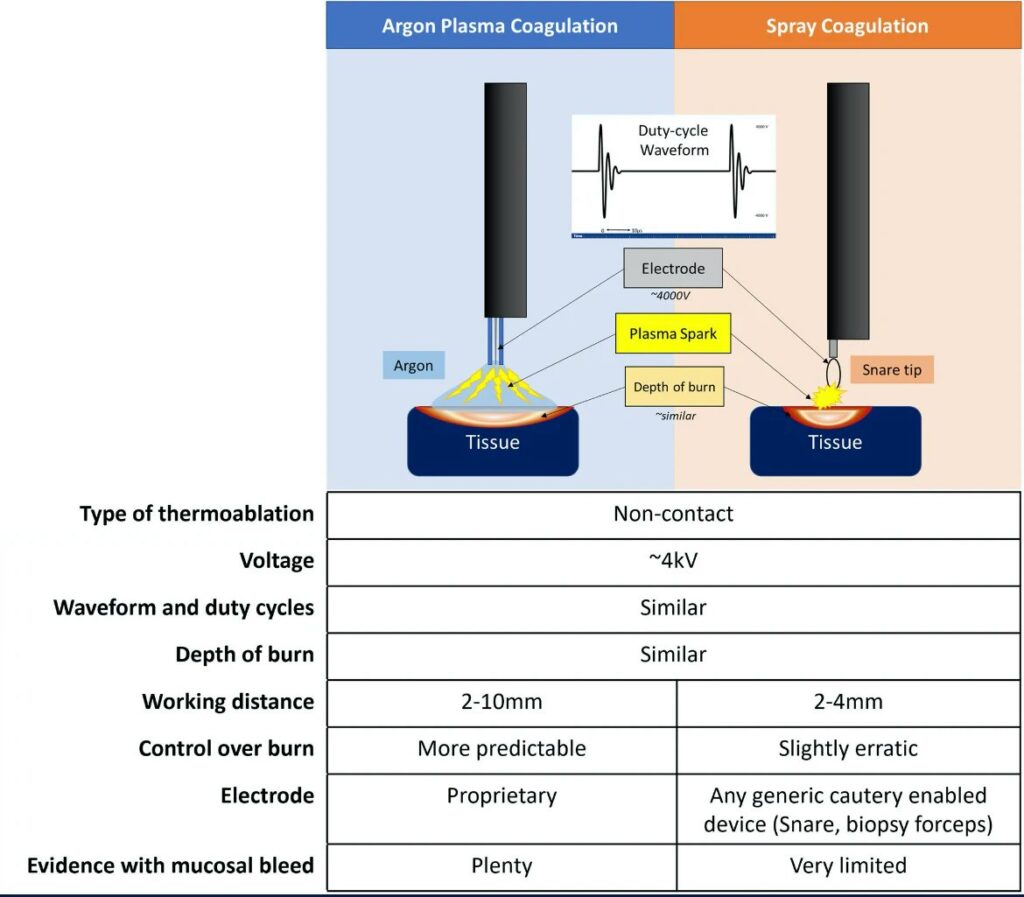 Spray Coagulation – a potential equivalent to argon plasma coagulation