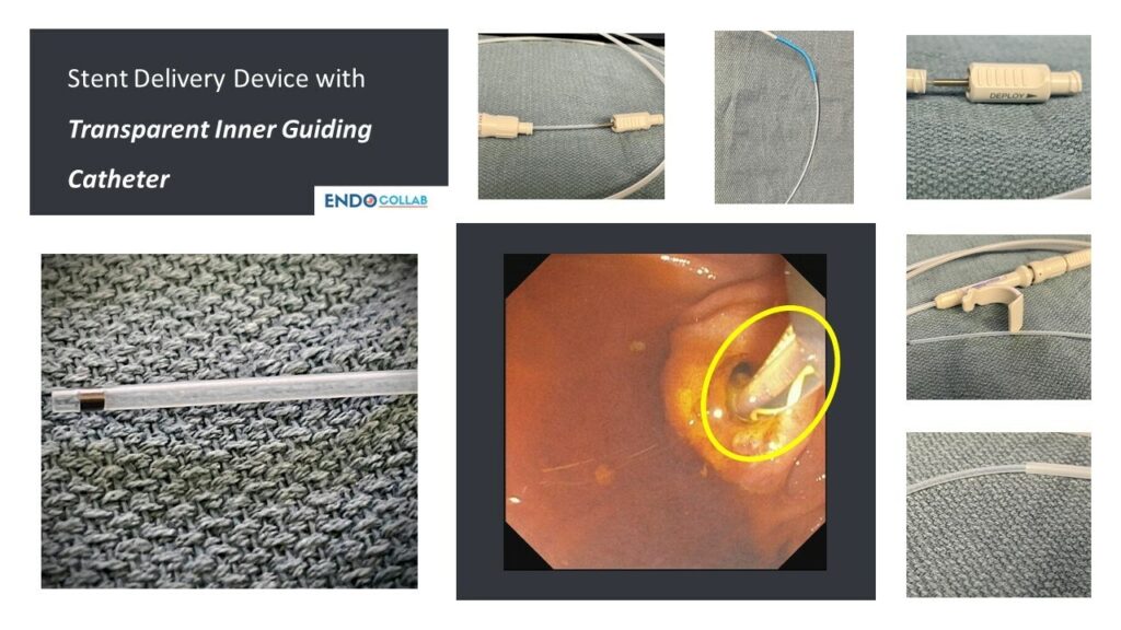 Stent Delivery Device with Transparent Inner Guiding Catheter