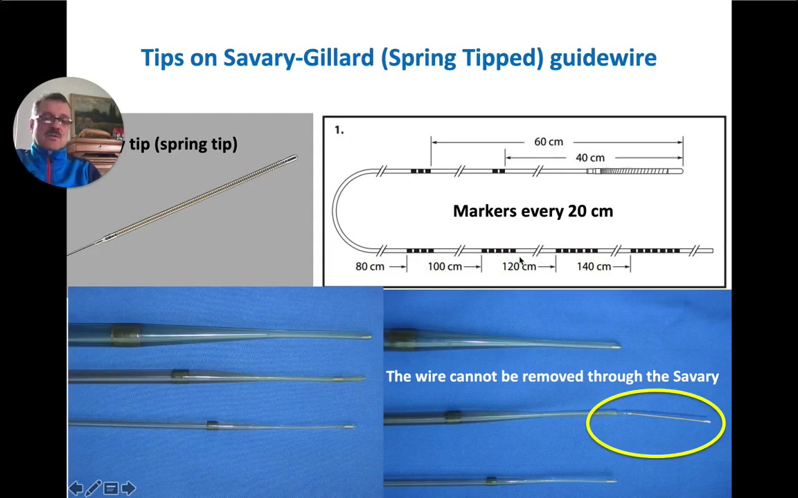 Esophageal Stricture Dilation: Wire Rules, The Flipped Wire Technique, And The Rule Of Three 1 Savary-Gilliard Guidewire Slide Showing The Spring Tip And Shaft Markers Every 20 Centimeters Starting At 40 Centimeters