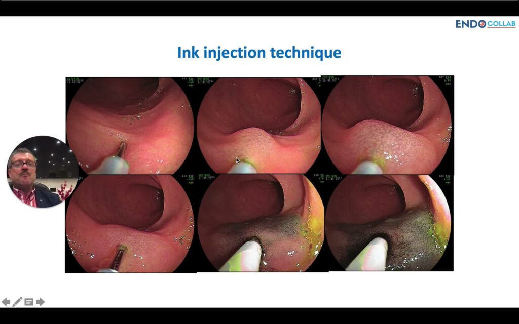 Tattooing - Tips And Tricks For The Best India Ink Tattoo 12 Tattooing – Tips And Tricks For The Best India Ink Tattoo
