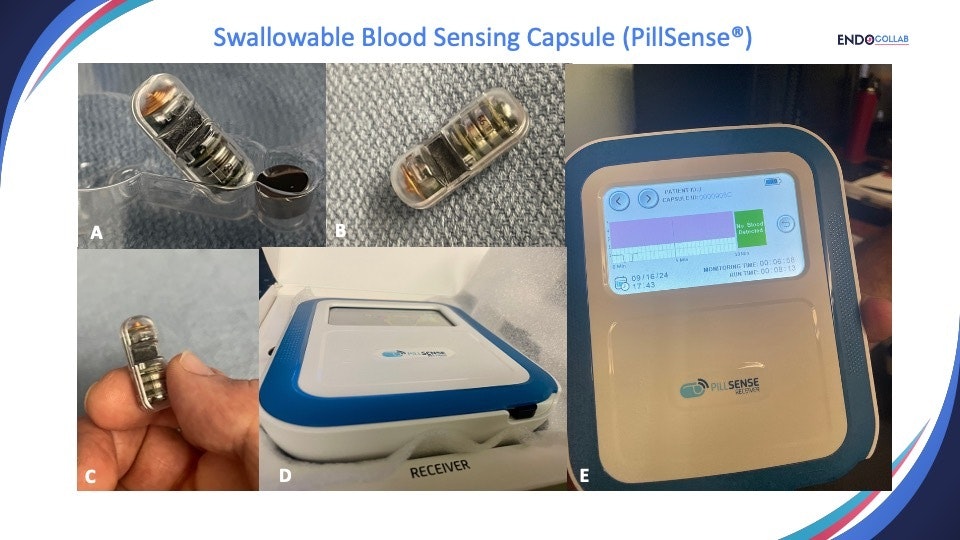 Technical Review: PillSense ®, a Novel Swallowable Capsule to Detect Upper Gastrointestinal Bleeding