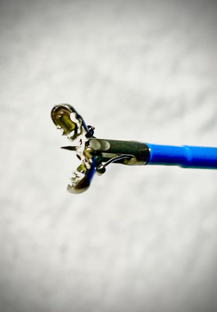 The “Jumbo” Biopsy Forceps