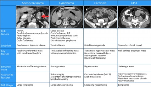 The Most Common Malignant Small Bowel Tumors 7 The Most Common Malignant Small Bowel Tumors