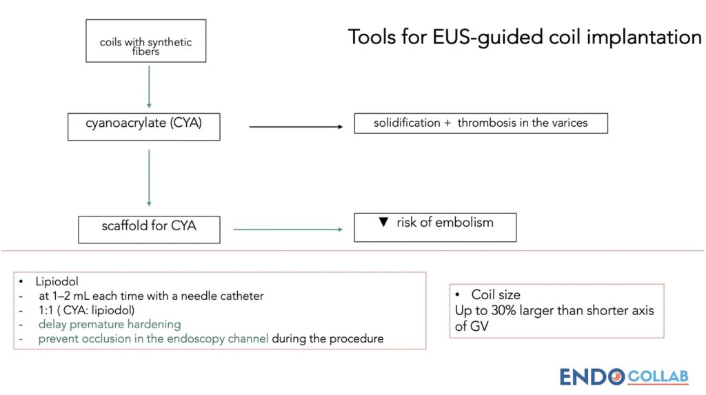 The Treatment Of Gastric Varices Under Eus Guidance (Coils + Cya). 1 The Treatment Of Gastric Varices Under Eus Guidance (Coils + Cya).