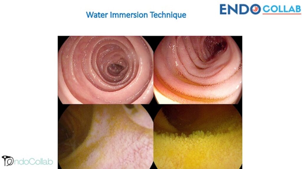 The Water Immersion Technique 5 The Water Immersion Technique