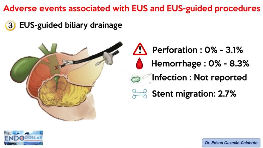 Adverse Events Associated With Eus And Eus-Guided Procedures