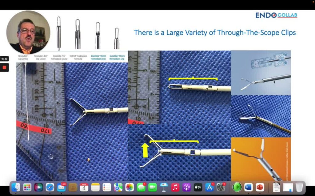 Tips And Tricks For Using Hemostatic Clips