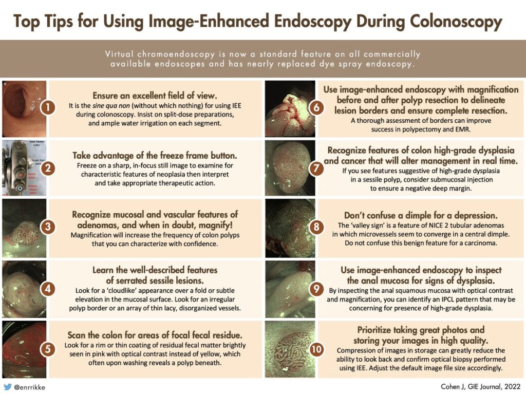 Top Tips For Using Image-Enhanced Endoscopy During Colonoscopy By Dr. J. Cohen 7 Top Tips For Using Image-Enhanced Endoscopy During Colonoscopy By Dr. J. Cohen