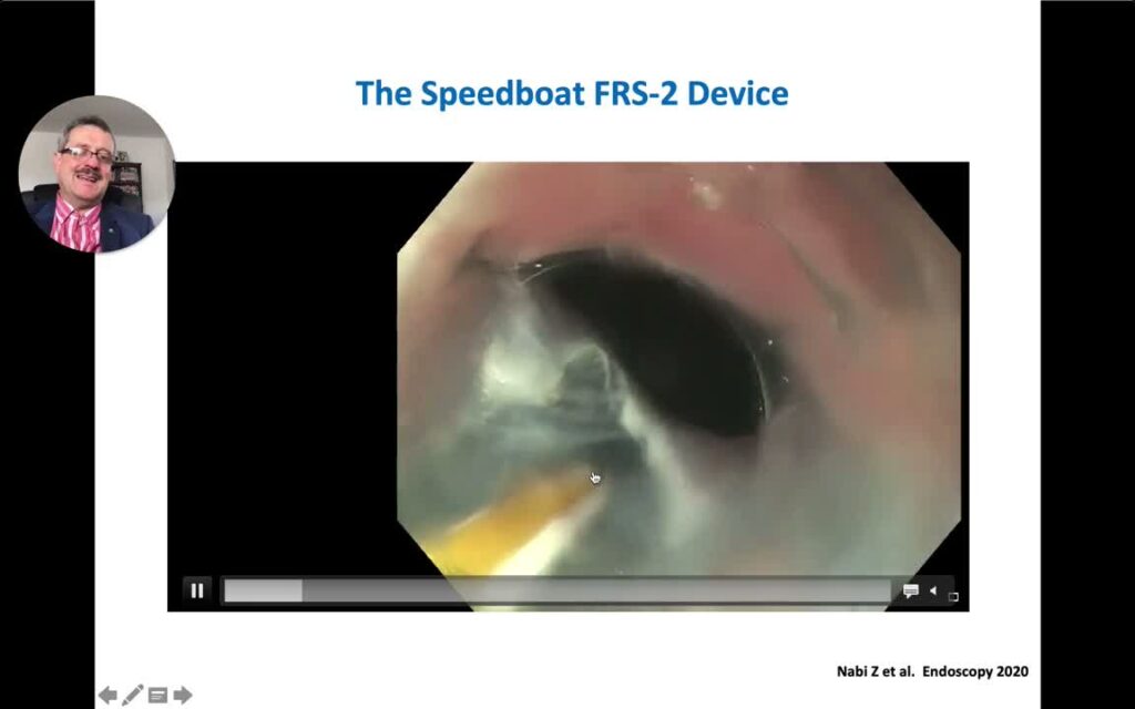 Un Nuevo Utensilio Para Resección Endoscópica- El “Bote O Lancha De Carrera, “Speedboat Device”