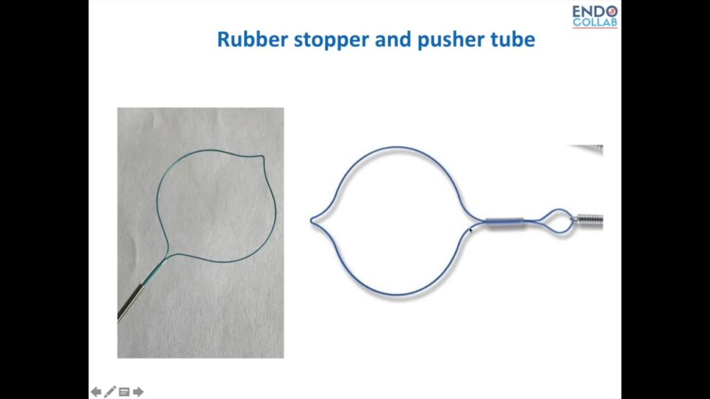 Endoloops (Asas Hemostáticas) En Endoscopía