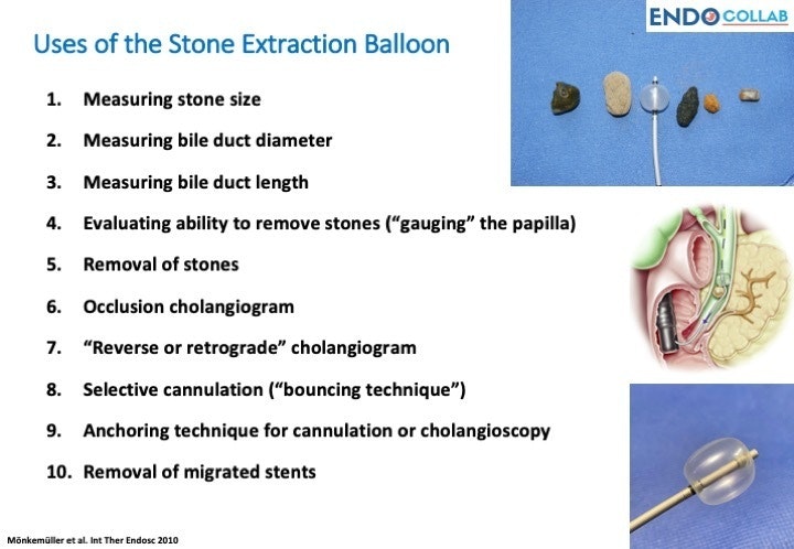 Uses Of The Stone Extraction Balloon 1 Uses Of The Stone Extraction Balloon