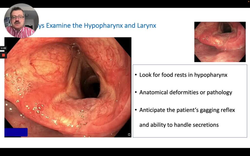 Using a Distal Cap to Remove Meat Impaction