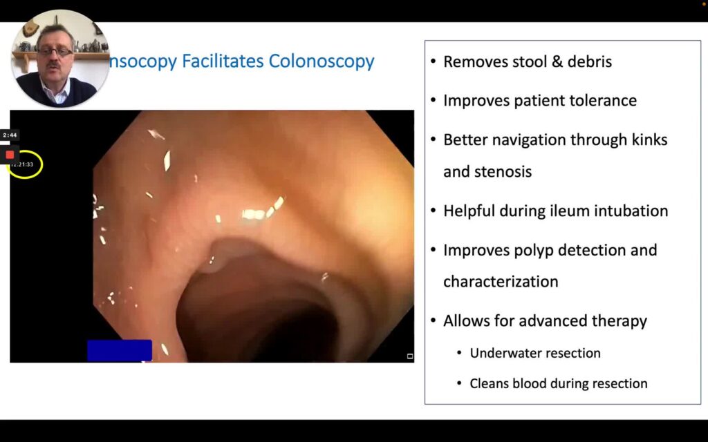 Water-Asssited (Immersion) Colonoscopy (Hydrocolonoscopy)