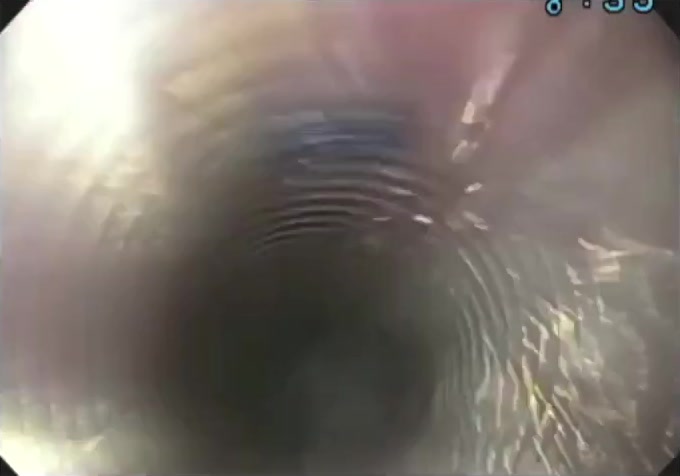 Overtube Advanced Into The Stomach Before Foreign Body Grasp