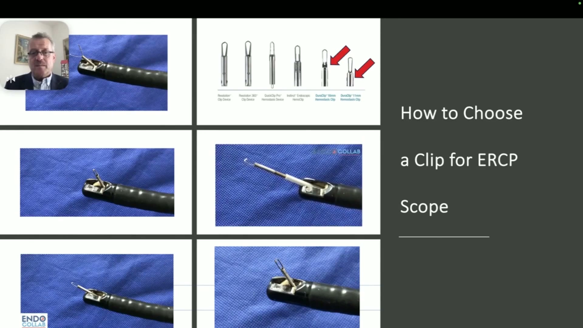 How To Choose A Clip For An Ercp Scope, Arrows On The Two Shortest Hemostasis Clips