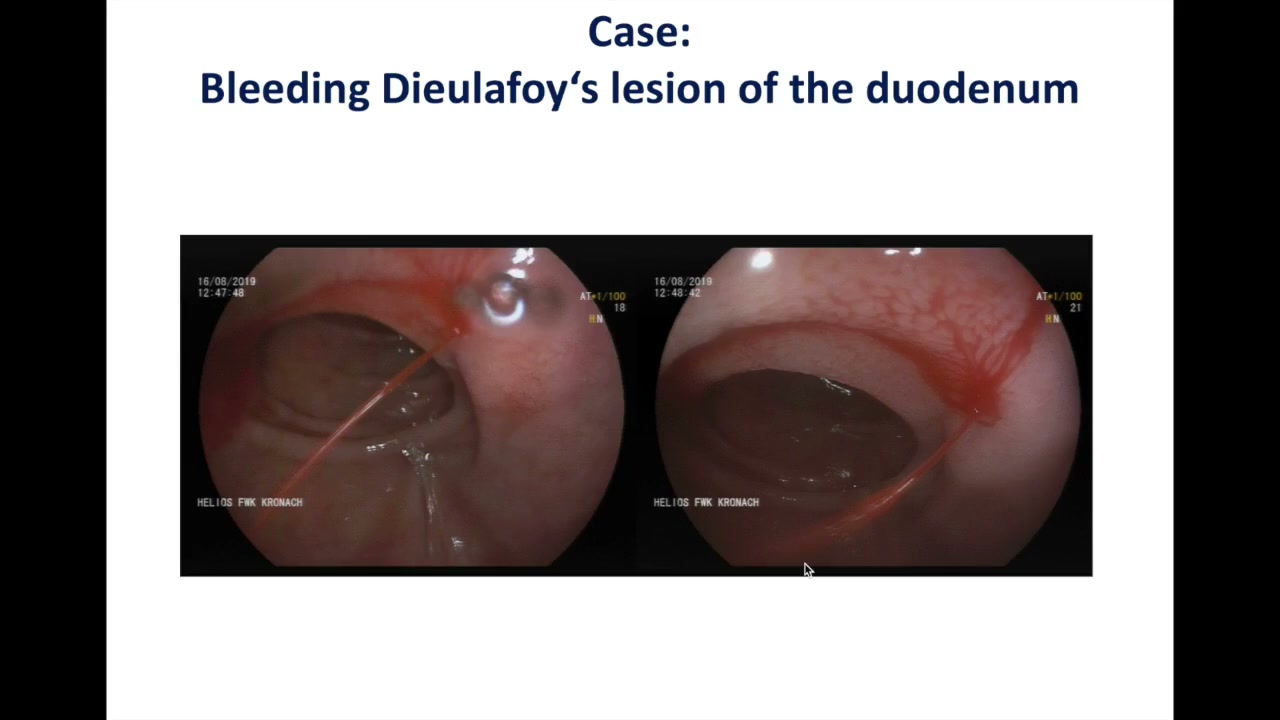 Bleeding On The Right, Channel On The Left: What Would You Do?