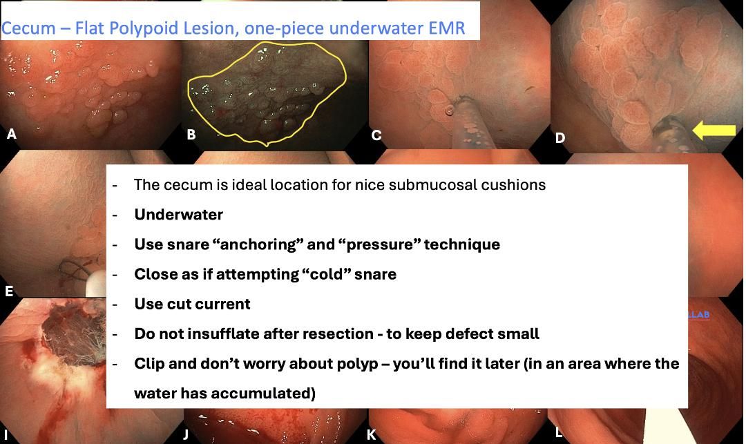Companion Slide With Underwater Emr Steps
