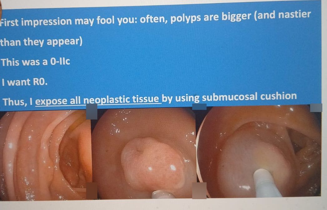 Gi Endoscopy Community &Amp; Education - Endocollab