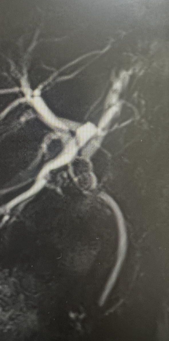 Mrcp Image Posted With The Case