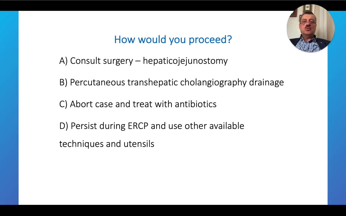 Slide: How Would You Proceed? Four Options