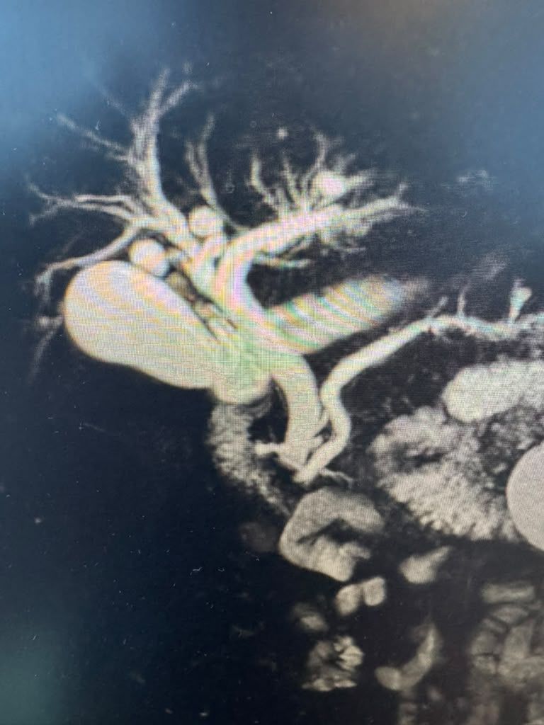 Mrcp Image Posted With The Case